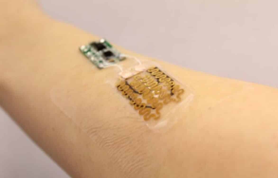 Smart bandage