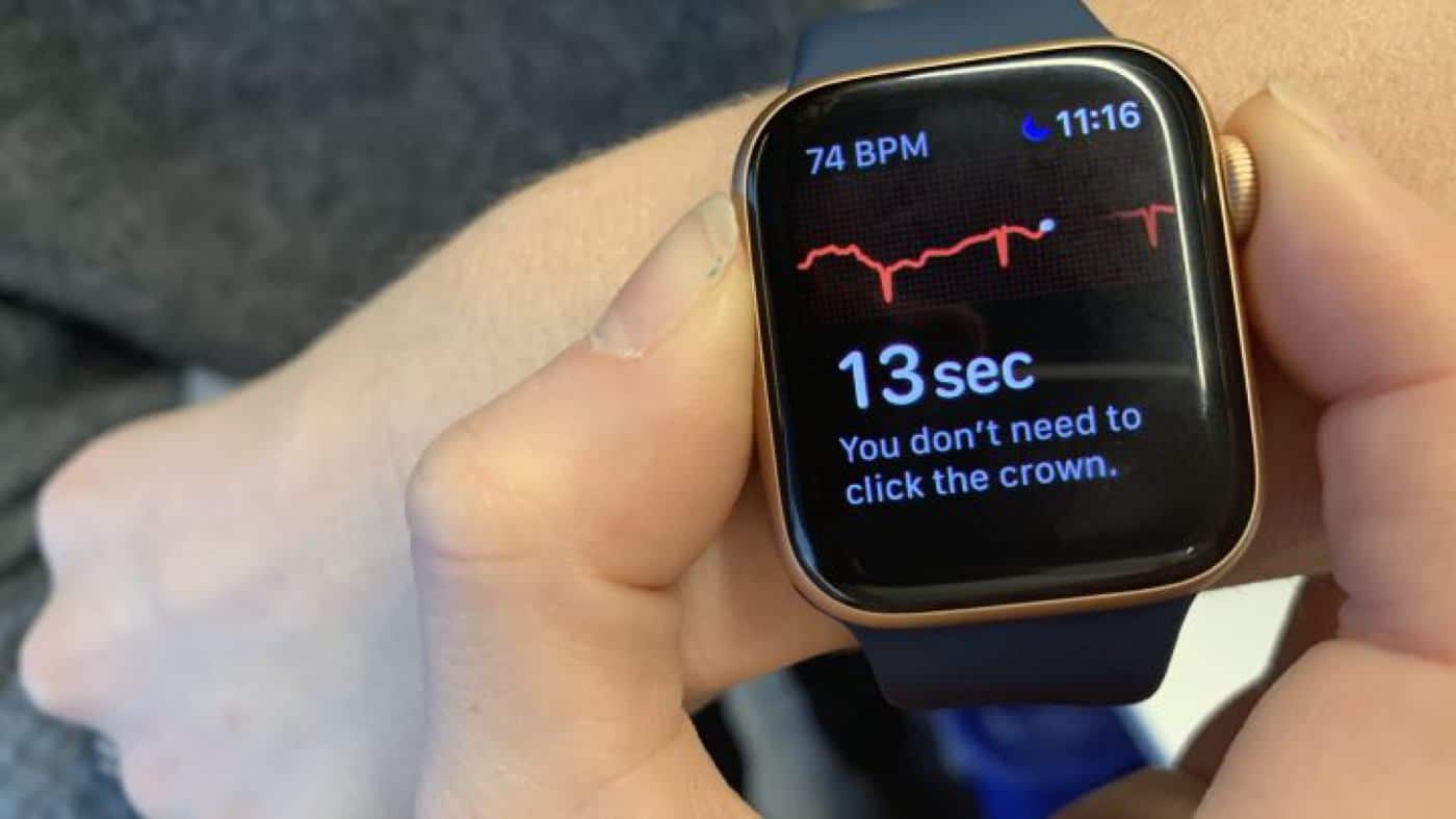 apple watch being used as an electrocardiogram